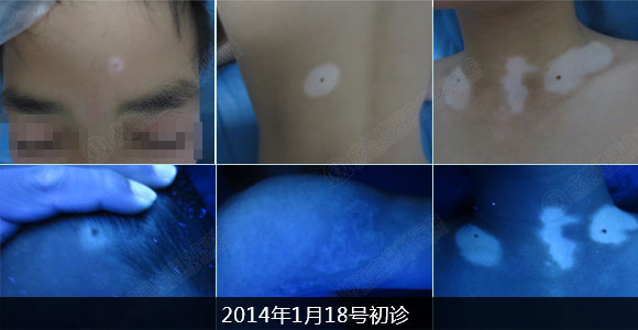 李某1.jpg